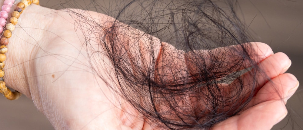 The most common root causes of hair loss — trichology guide