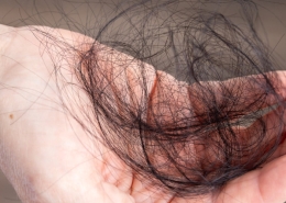 The most common root causes of hair loss — trichology guide