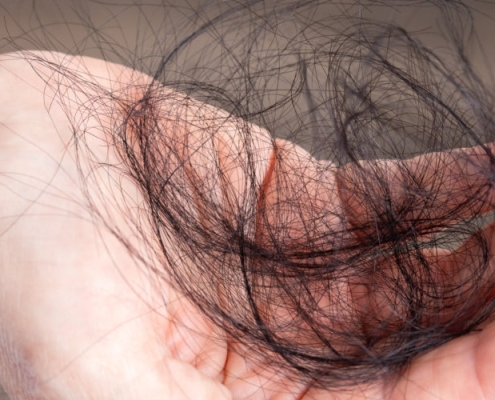 The most common root causes of hair loss — trichology guide