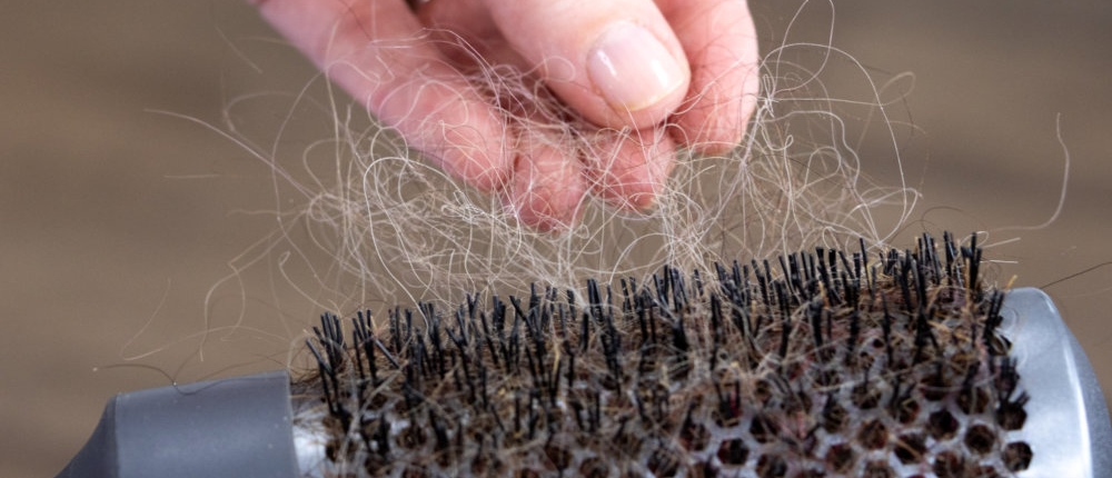 Why hair loss treatments fail — expert insight from Tricho Health Clinic