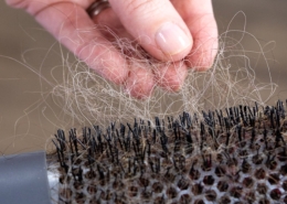 Why hair loss treatments fail — expert insight from Tricho Health Clinic