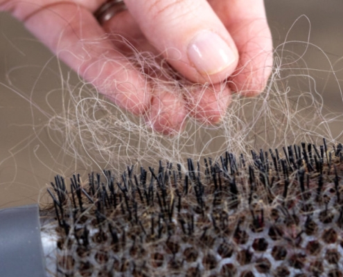 Why hair loss treatments fail — expert insight from Tricho Health Clinic