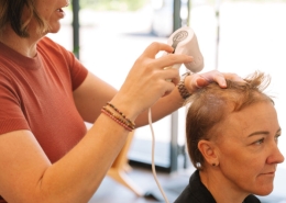 Dandruff vs seborrhoeic dermatitis — scalp condition comparison
