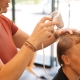 Dandruff vs seborrhoeic dermatitis — scalp condition comparison