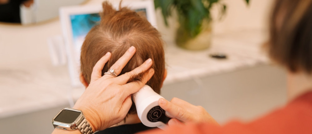 Tricho Female pattern hair loss (androgenetic alopecia) — trichology assessment Riverstone NSW
