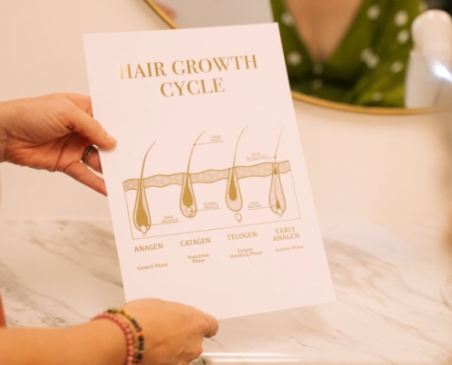 Iron deficiency causing hair thinning and increased shedding