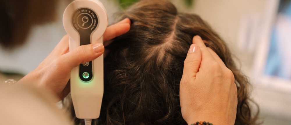 Why hair texture changes after pregnancy — hormonal effects explained