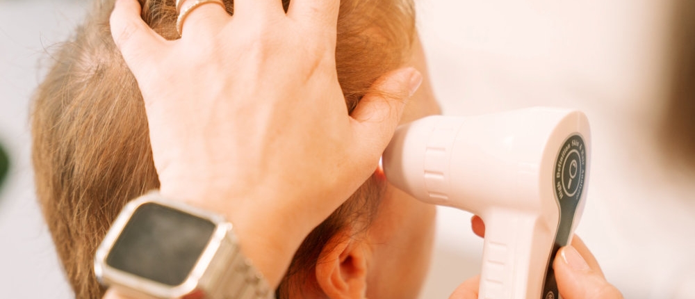 Scalp Conditions and Scalp Health